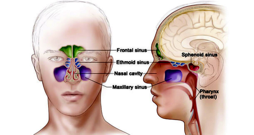 Nasal Cavity and Sinus Cancers